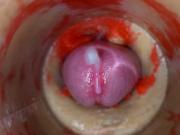 Camera deep inside tight pussy captures huge cum explosion 4k