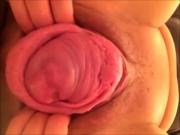 japanese prolapse