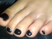 Macro closeup of amateur's black toenails