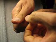 Foreskin basics